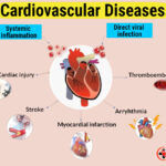 What is Cardiovascular Diseases?