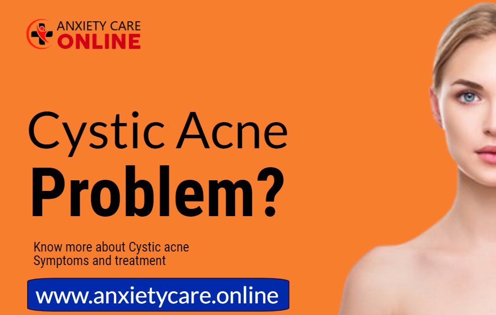 Cystic acne treatment